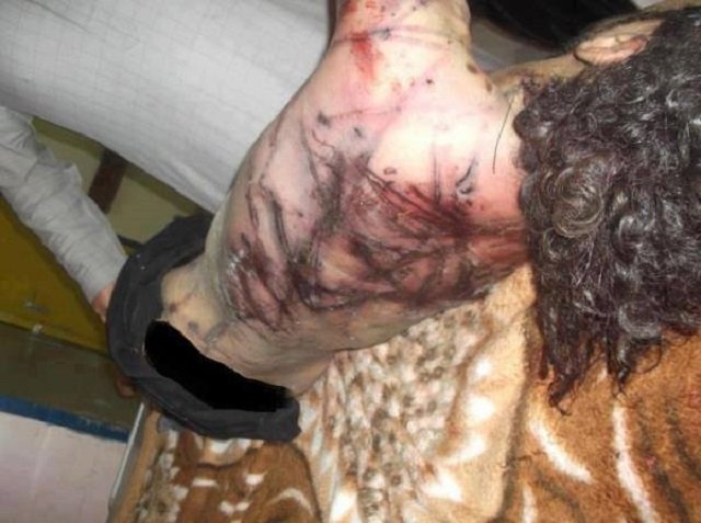 Gruesome Syria photos may prove torture by Assad regime