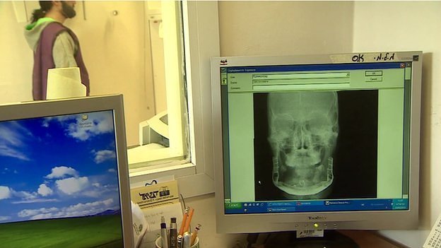 Israeli hospital rebuilds injured Syrian man’s face