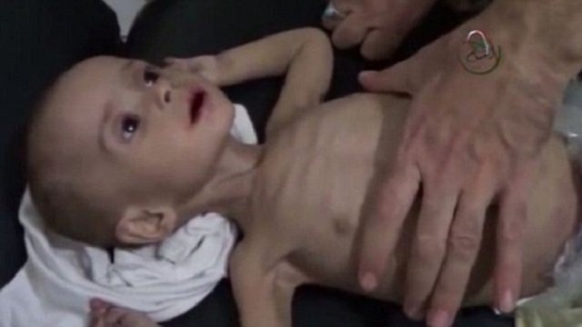 Obama is Complicit in Starving Syrian Civilians