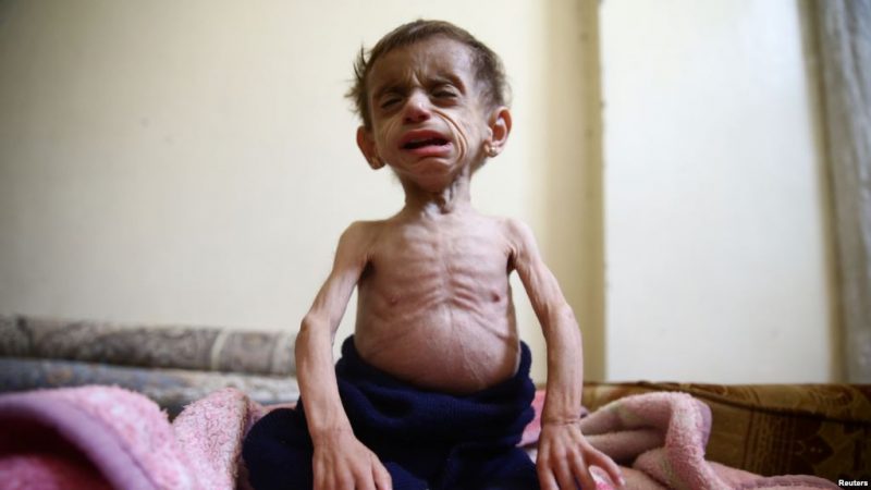 Deliberate Starvation of Civilians in Syria Could Be War Crime